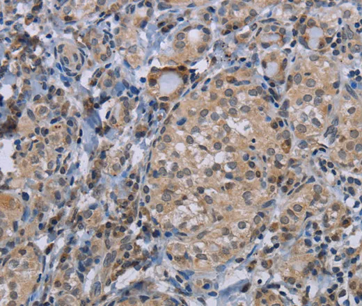 CDC16 Polyclonal Antibody - image 1