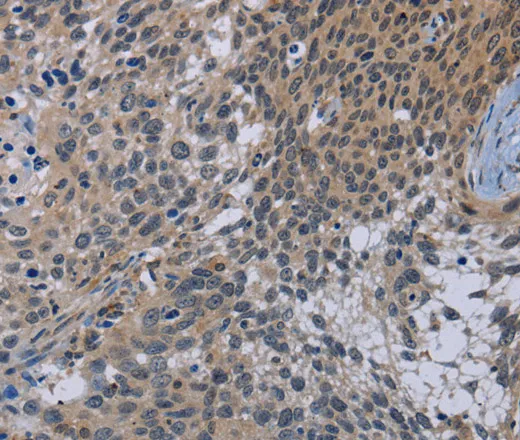 CDC16 Polyclonal Antibody - image 2