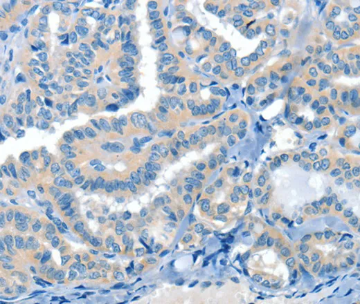 CRLF2 Polyclonal Antibody - image 1