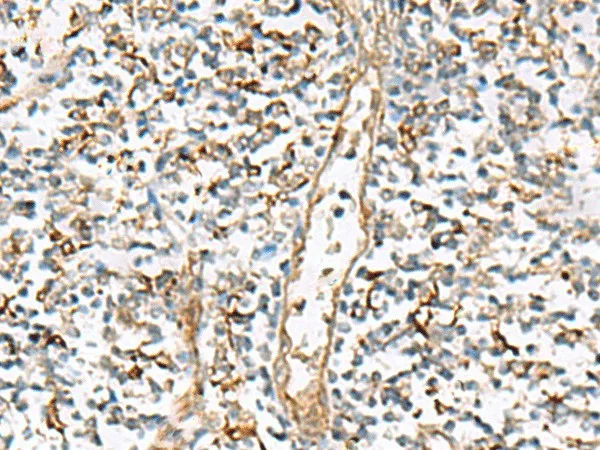 NPC2 Polyclonal Antibody - image 1