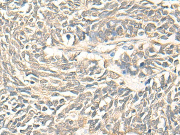 DMC1 Polyclonal Antibody - image 1