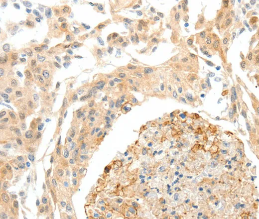 SEMA3D Polyclonal Antibody - image 1