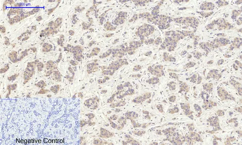 EIF2 alpha Polyclonal Antibody - image 1