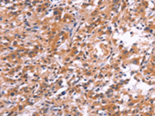 APMAP Polyclonal Antibody - image 1