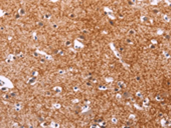 APMAP Polyclonal Antibody - image 2