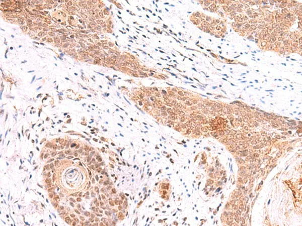 COPS3 Polyclonal Antibody - image 1