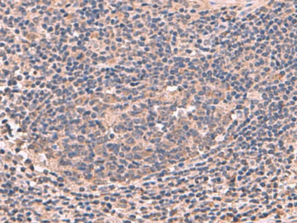 MAGEC2 Polyclonal Antibody - image 1