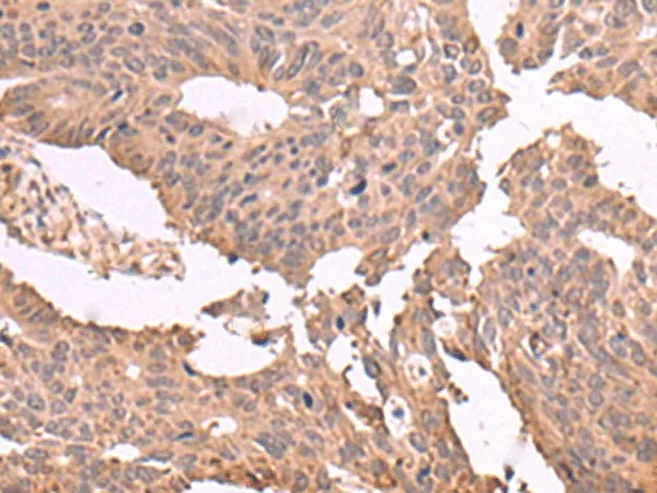 MAGEC2 Polyclonal Antibody - image 2