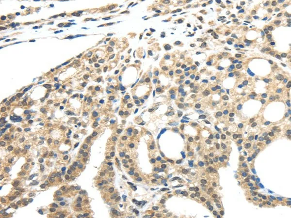 INHBB Polyclonal Antibody - image 1