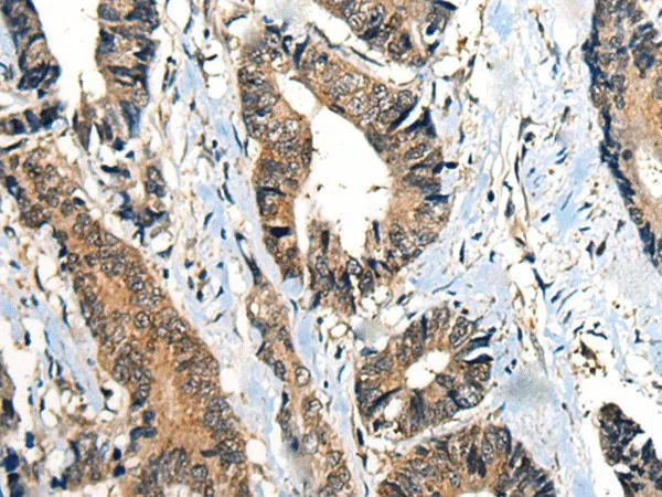 BMPER Polyclonal Antibody - image 1