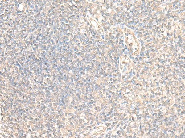 PARS2 Polyclonal Antibody - image 1