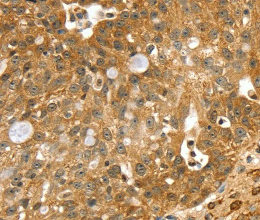 SORT1 Polyclonal Antibody - image 1