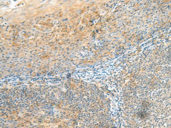 CLEC3B Polyclonal Antibody - image 1