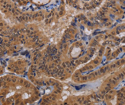 MCTS1 Polyclonal Antibody - image 1