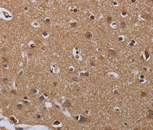 MCTS1 Polyclonal Antibody - image 2