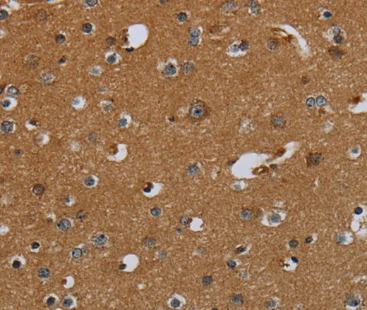 PCK2 Polyclonal Antibody - image 1