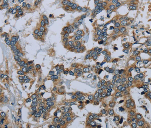 PCK2 Polyclonal Antibody - image 2