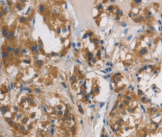 DUSP26 Polyclonal Antibody - image 1