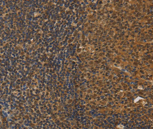 DAB2 Polyclonal Antibody - image 1