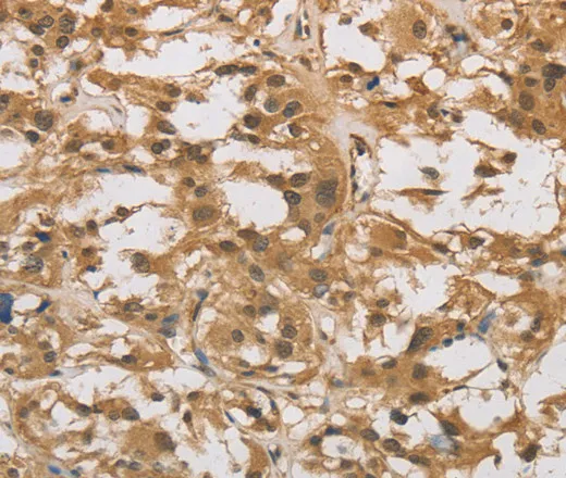 DAB2 Polyclonal Antibody - image 2