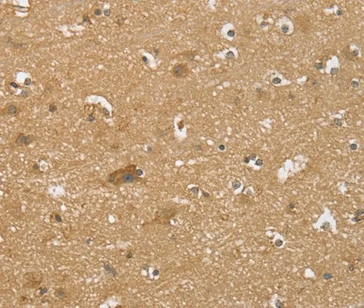 RNF148 Polyclonal Antibody - image 1