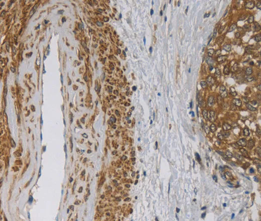 EMC8 Polyclonal Antibody - image 1