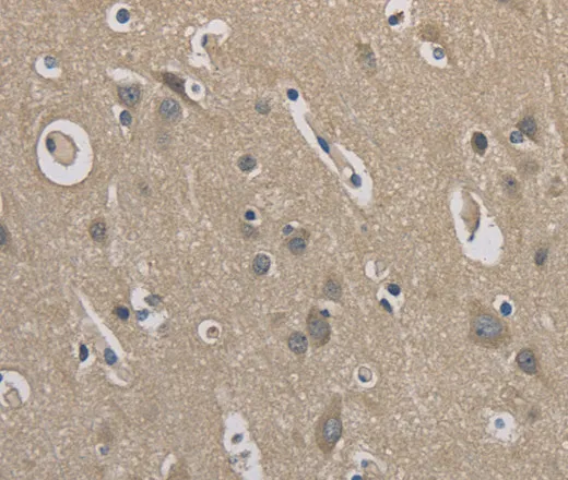 EMC8 Polyclonal Antibody - image 2