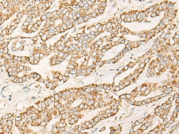 COX6C Polyclonal Antibody - image 1