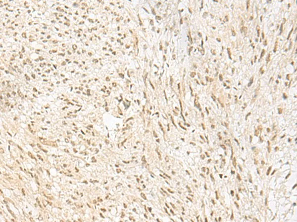 PSPC1 Polyclonal Antibody - image 1