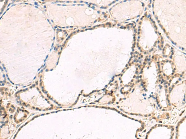 RNF13 Polyclonal Antibody - image 1