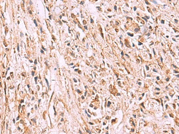 GPC2 Polyclonal Antibody - image 1
