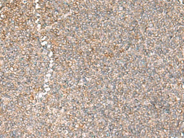 GIMAP2 Polyclonal Antibody - image 1