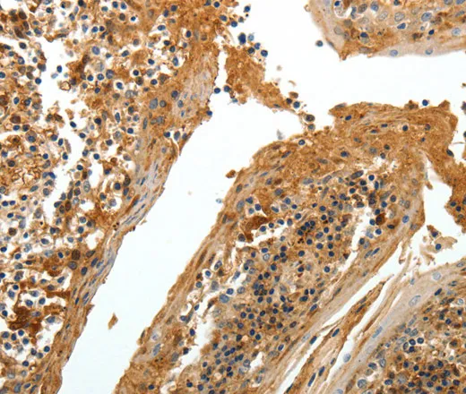 TNR Polyclonal Antibody - image 1