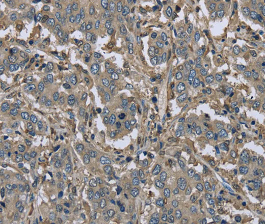 FBP1 Polyclonal Antibody - image 1