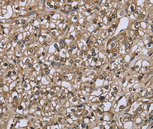 FBP1 Polyclonal Antibody - image 2