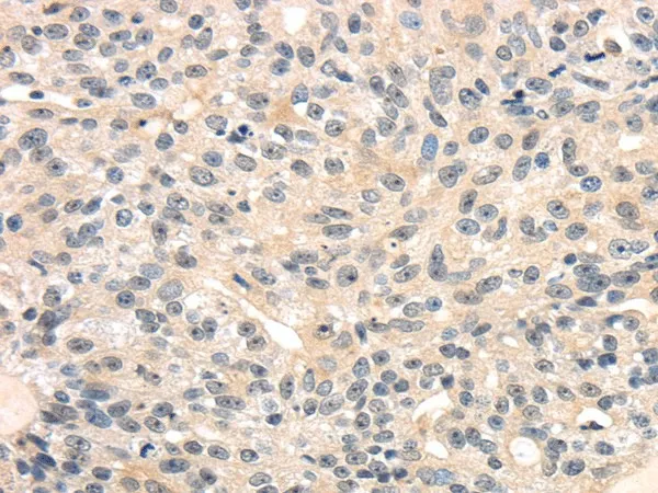 TRIB3 Polyclonal Antibody - image 1