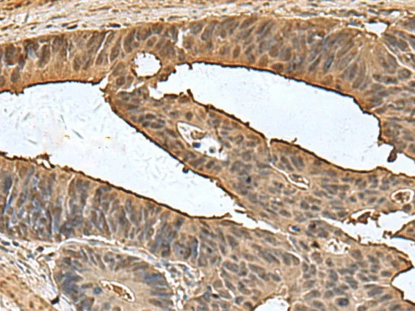DCTPP1 Polyclonal Antibody - image 1