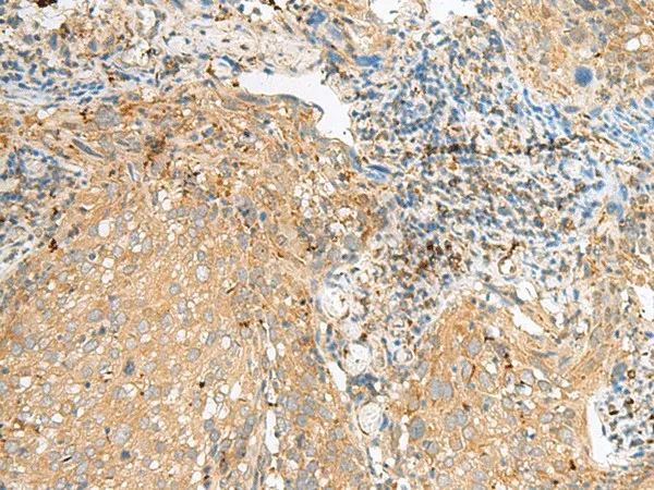 COPE Polyclonal Antibody - image 1