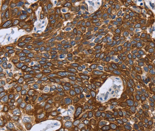 GRPR Polyclonal Antibody - image 1