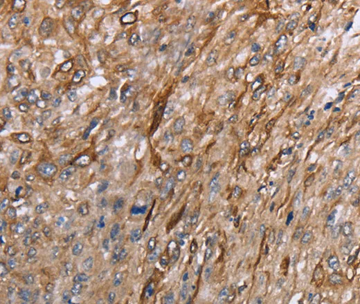 GRPR Polyclonal Antibody - image 2