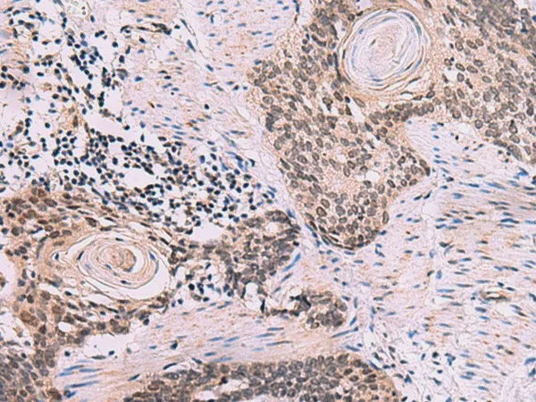 CDK4 Polyclonal Antibody - image 1