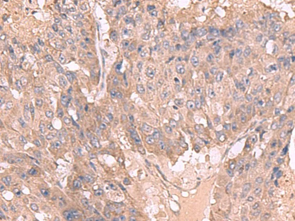 MAGEC2 Polyclonal Antibody - image 1