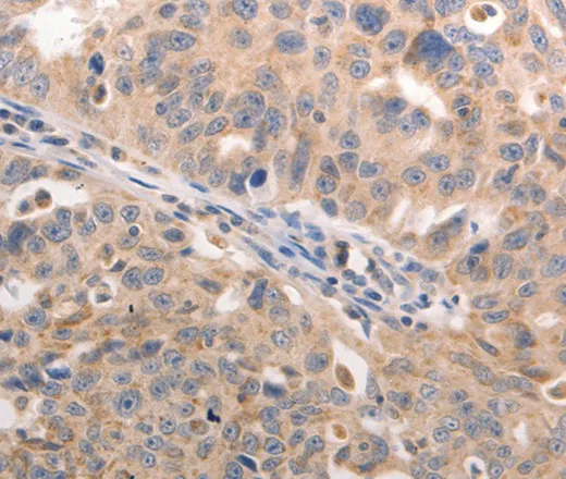 BGLAP Polyclonal Antibody - image 1