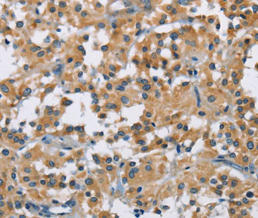 DNMT3A Polyclonal Antibody - image 1