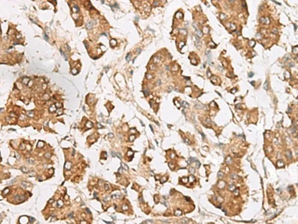 SLC40A1 Polyclonal Antibody - image 1