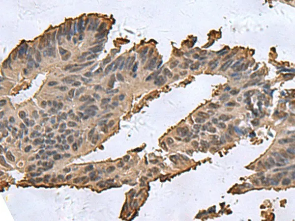 DCTPP1 Polyclonal Antibody - image 1