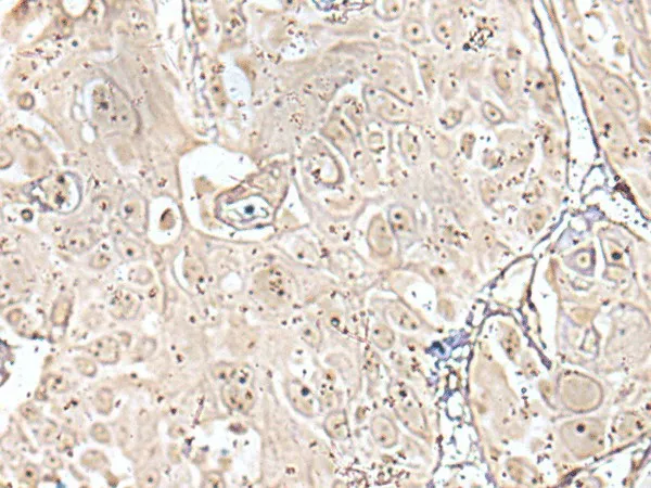 VRK3 Polyclonal Antibody - image 1