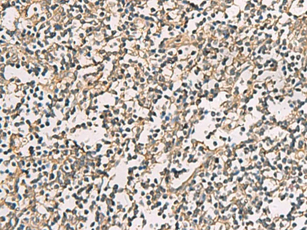 CMTM4 Polyclonal Antibody - image 1