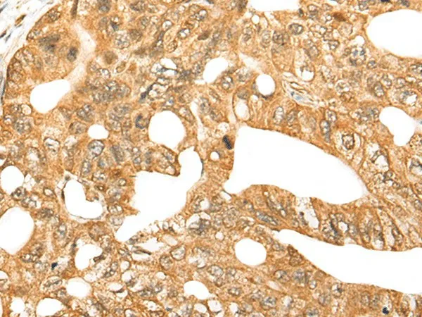 CDCA4 Polyclonal Antibody - image 1