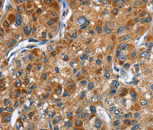 DRAK2 Polyclonal Antibody - image 1